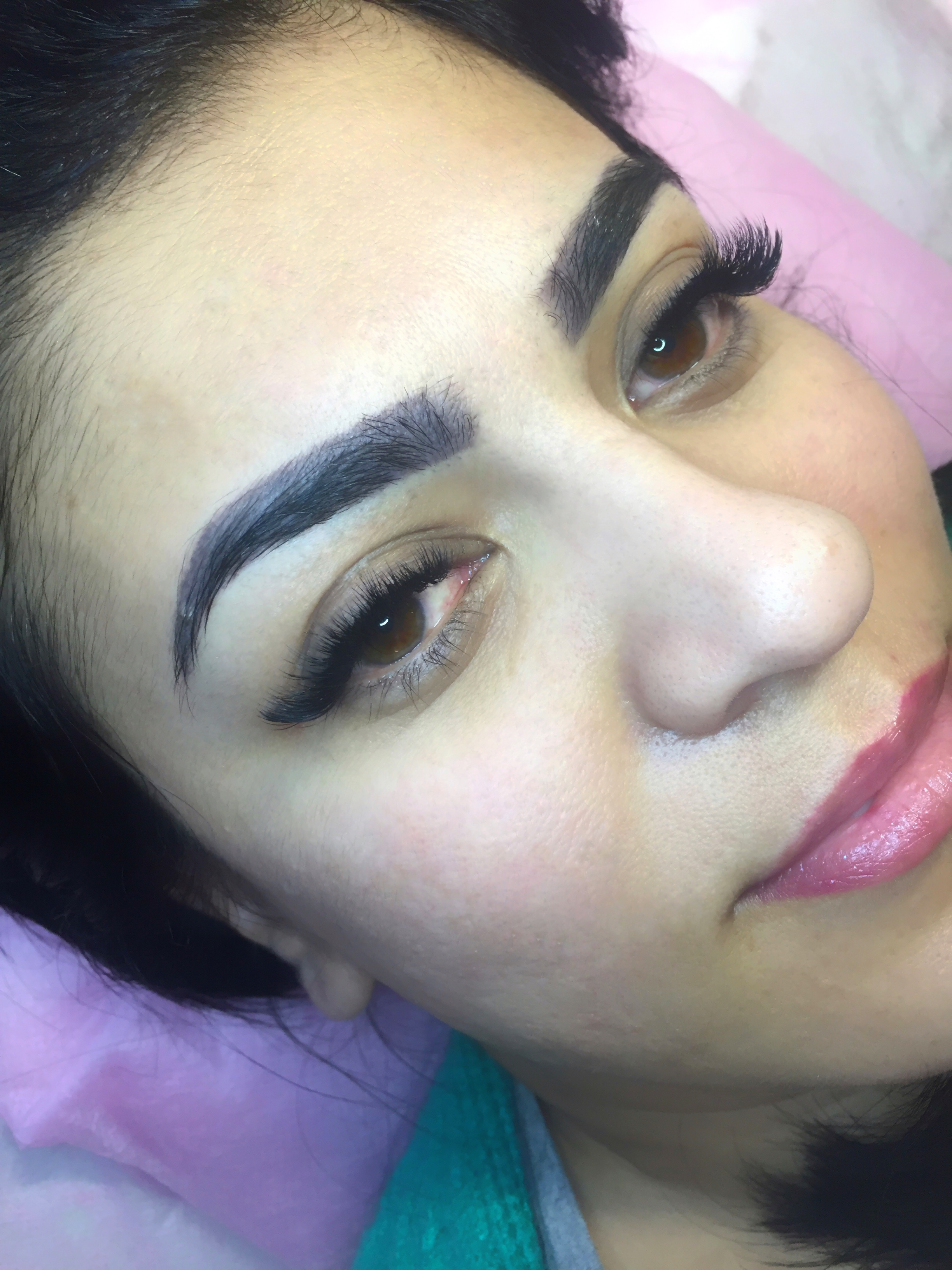 Фото Лисий эффект-3д