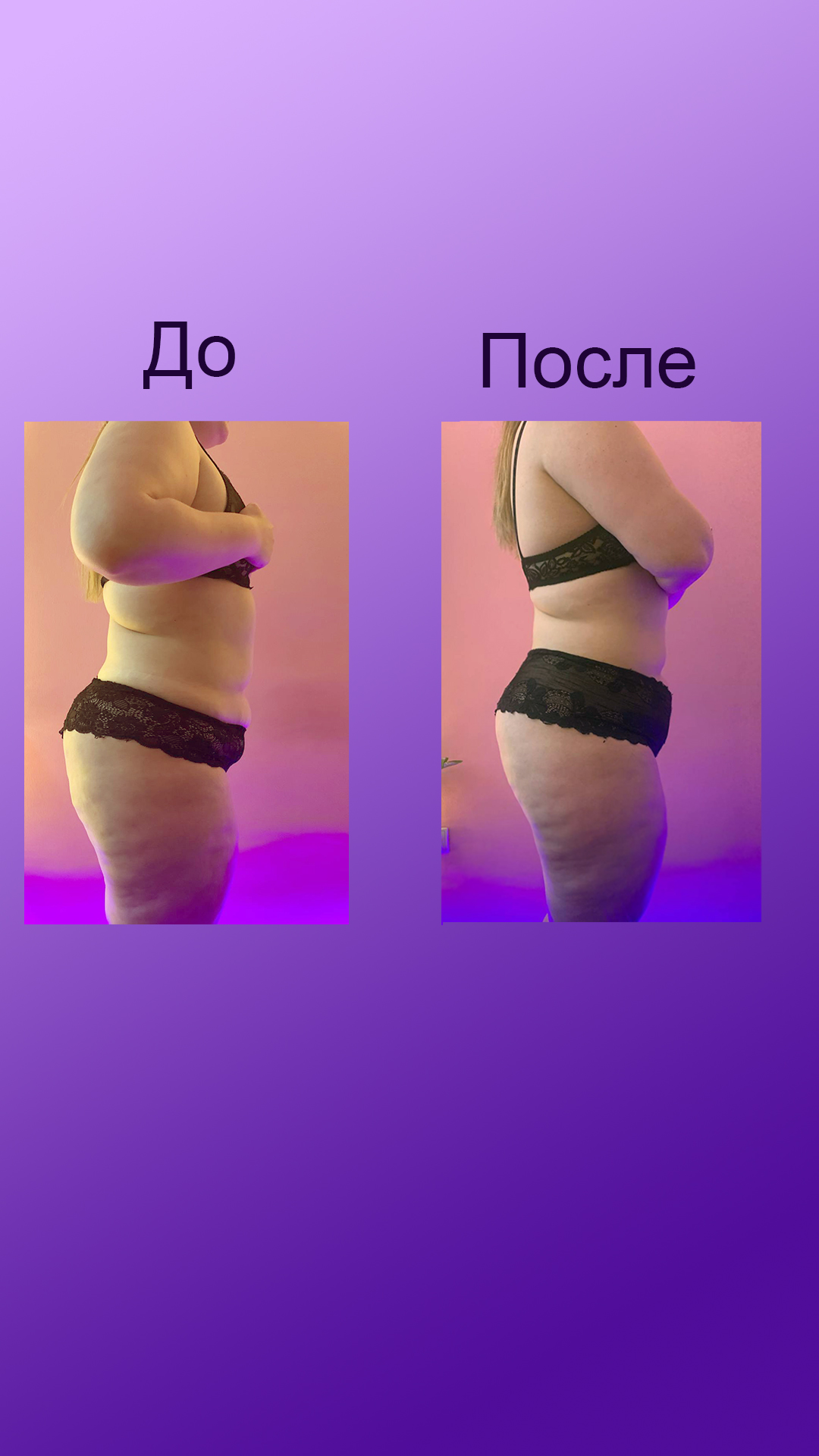 Фото Аппаратная корекция тела