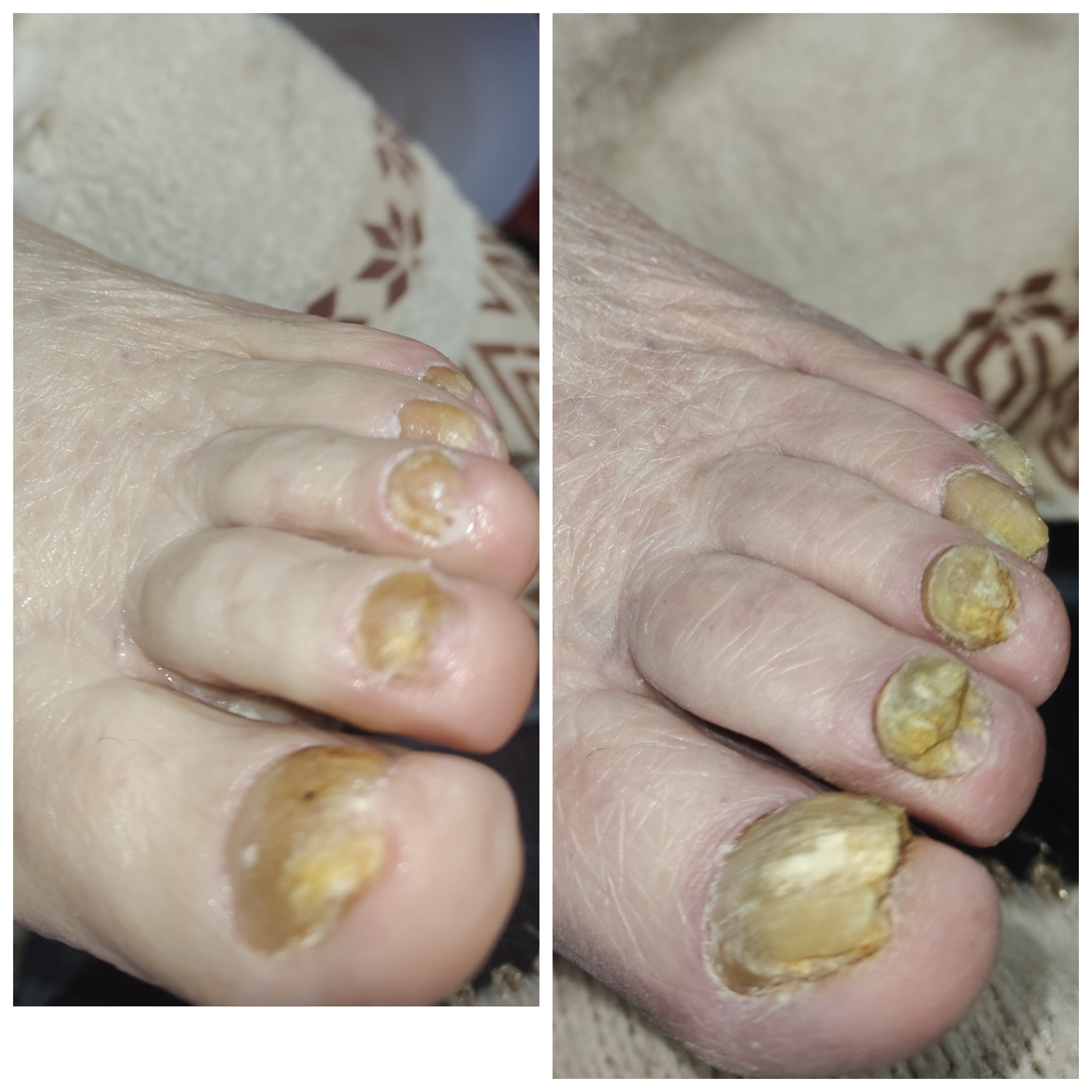 Фото педікюр 