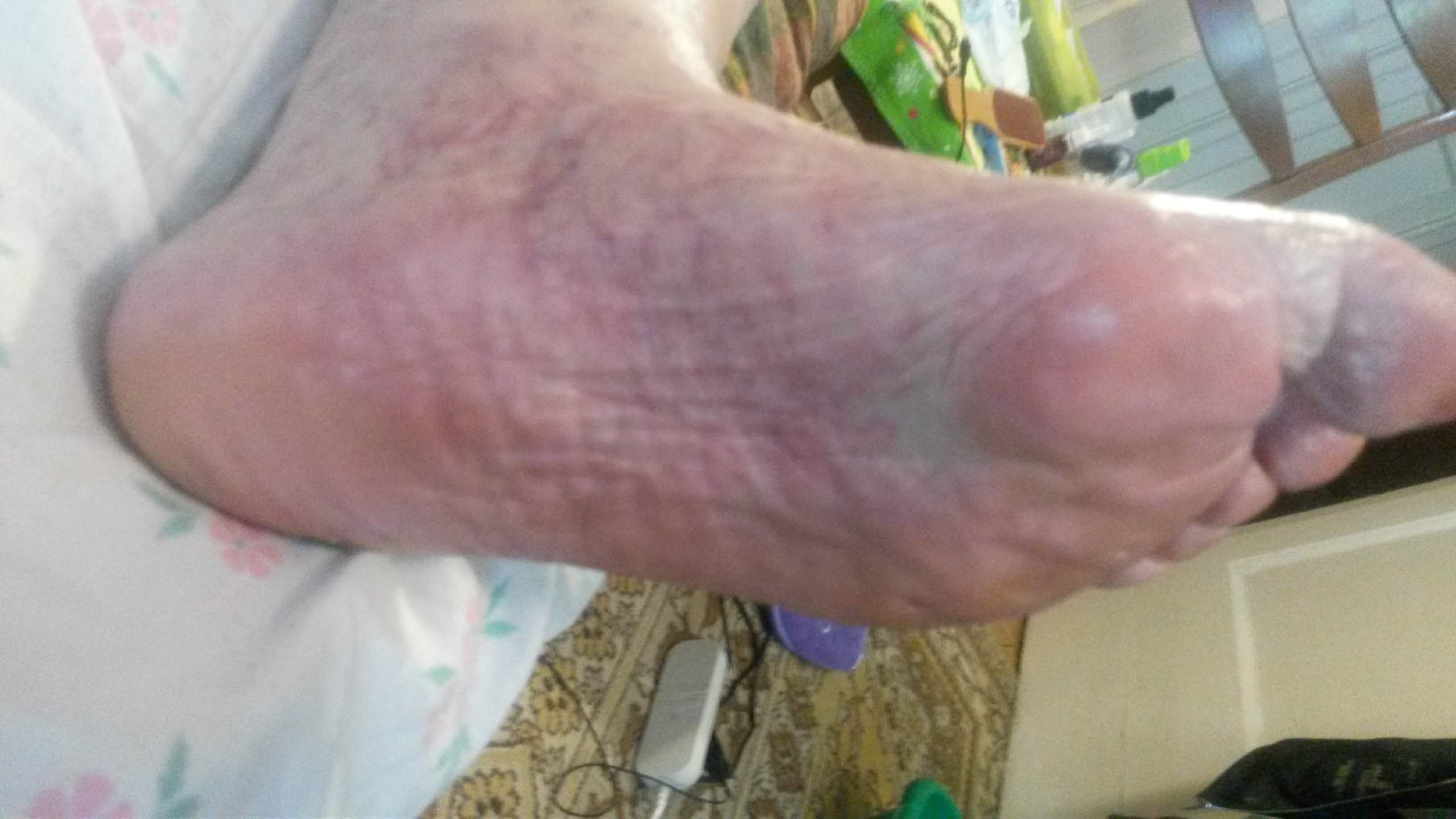 Фото Педикюр пожилым с выездом на дом  4