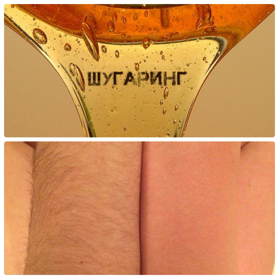 Фото Шугаринг 3