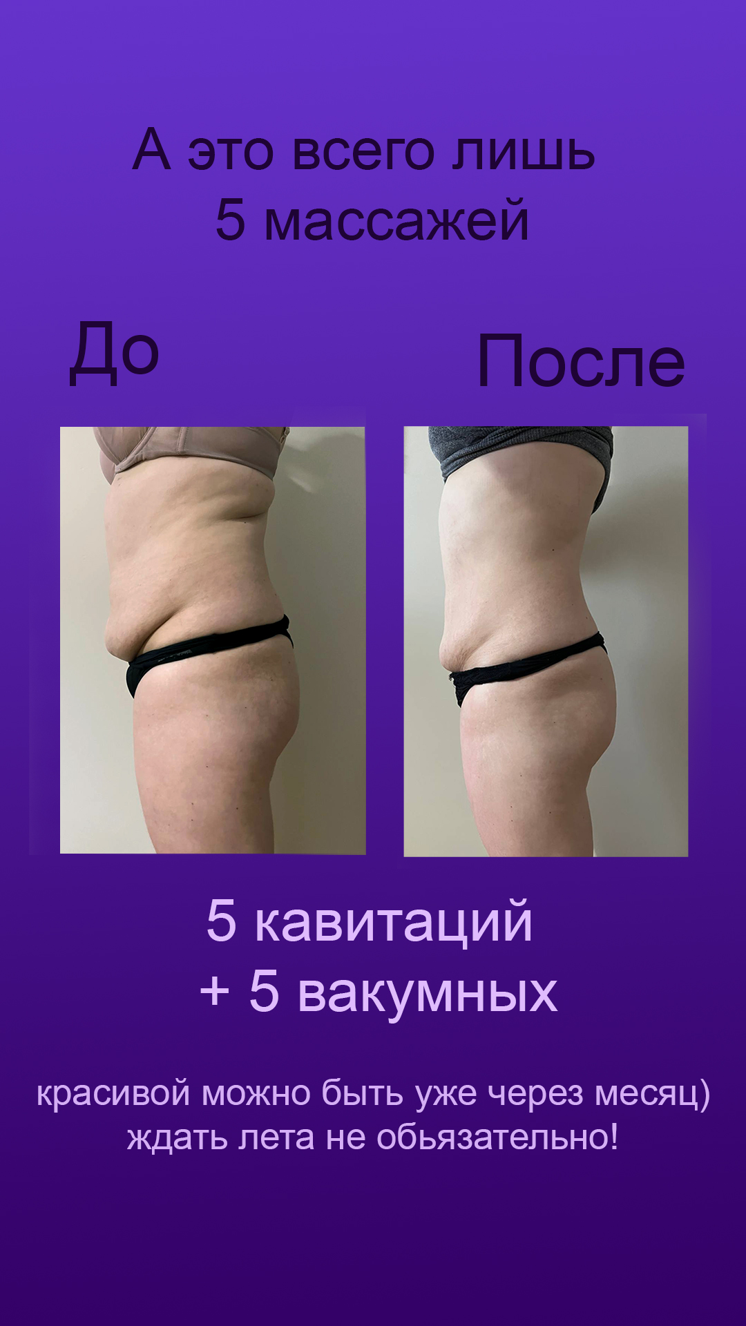 Фото Аппаратная корекция тела