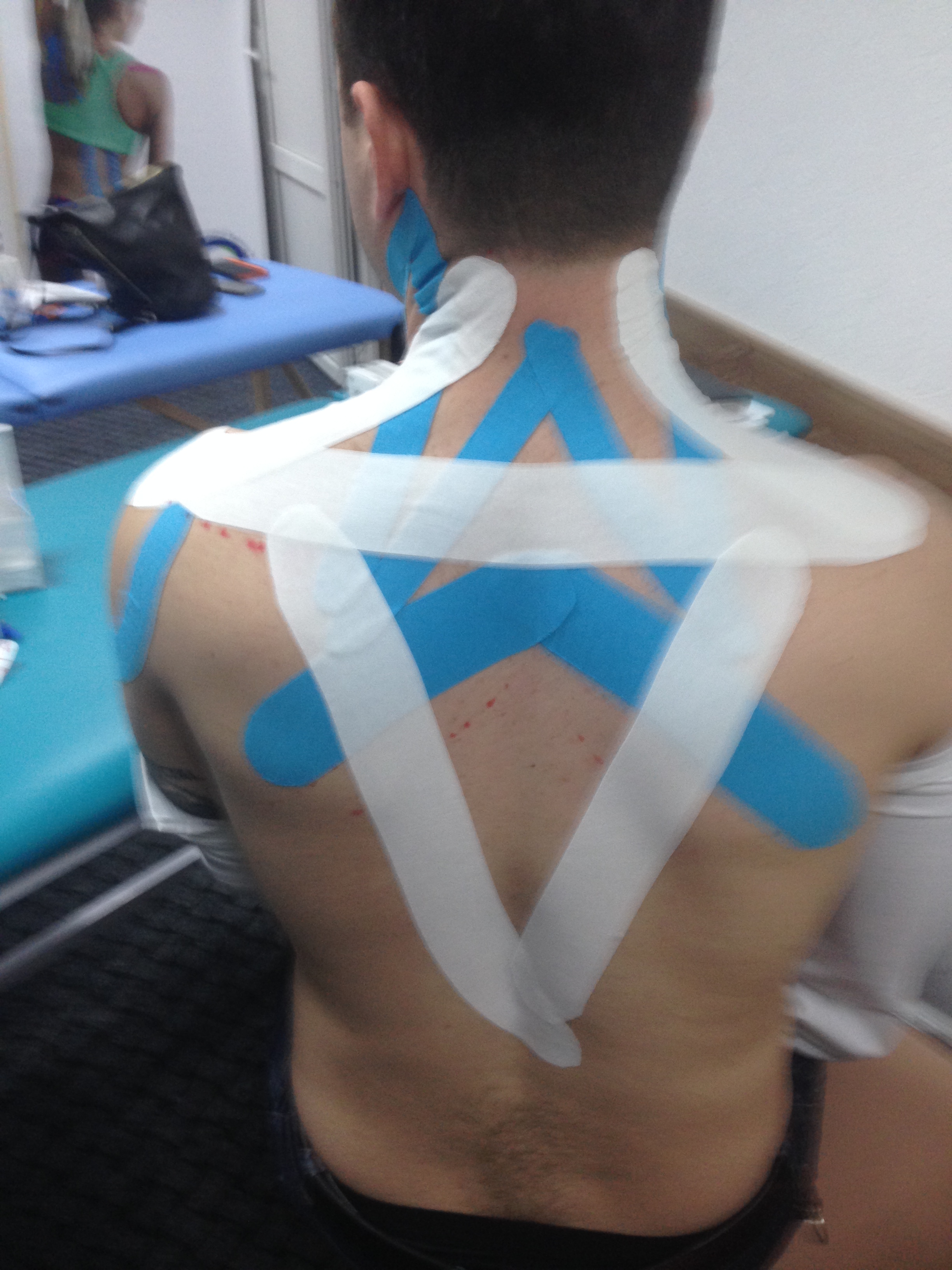 Фото Наложение кинезиологического тейпа на мышцы спиныи шейно-воротниковую зону