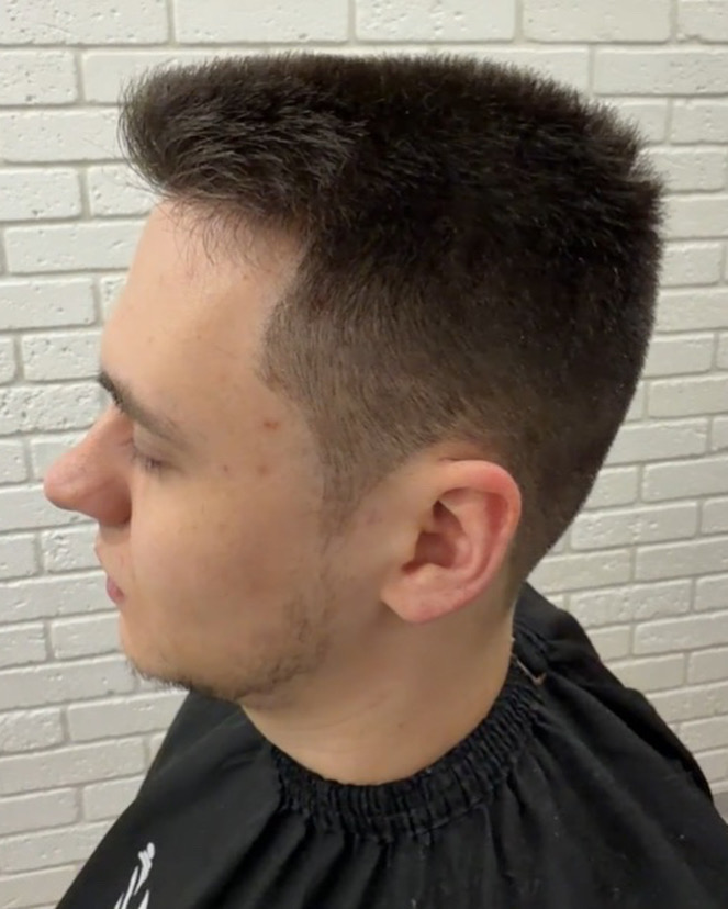 Фото flattop плоская топ зона 