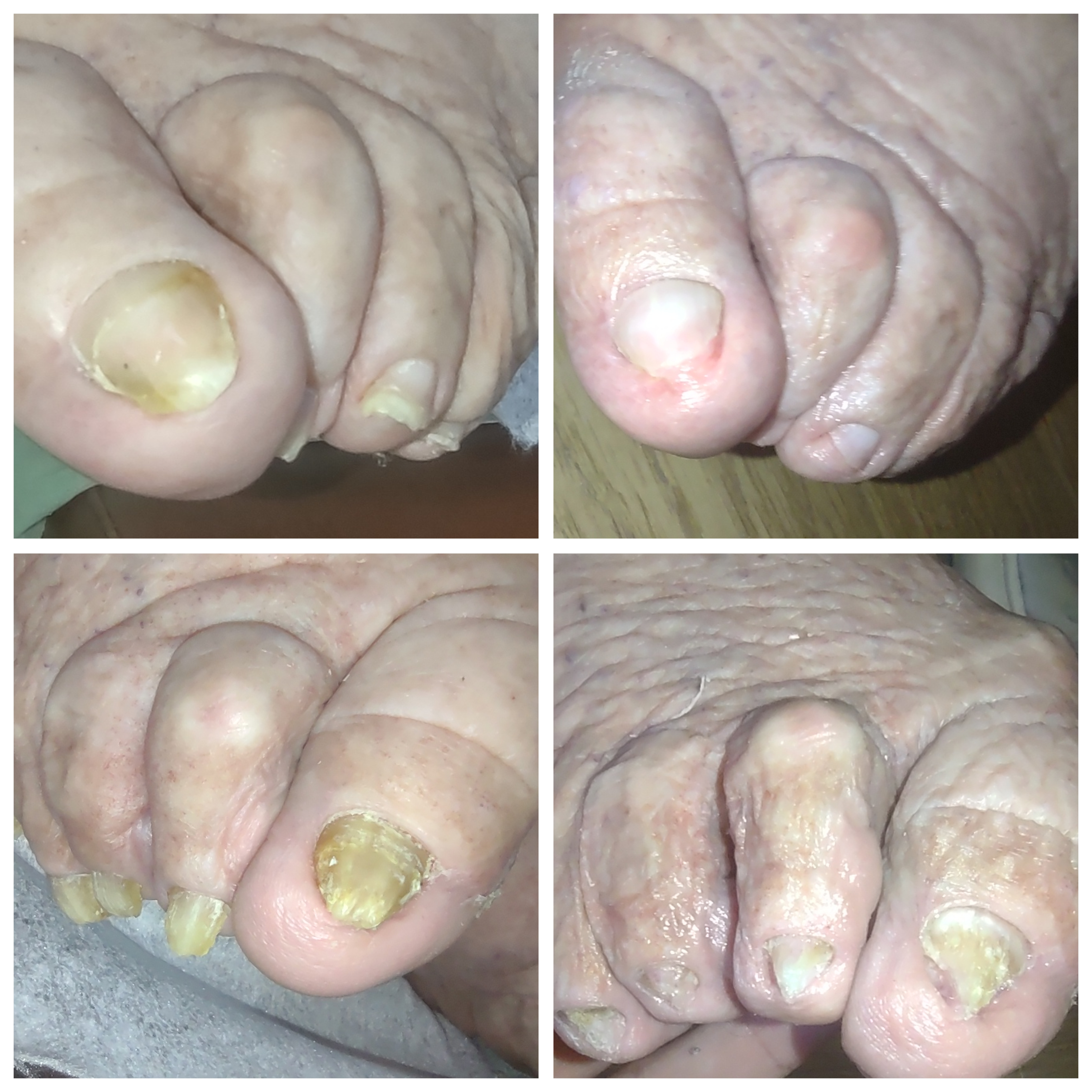 Фото Подолог