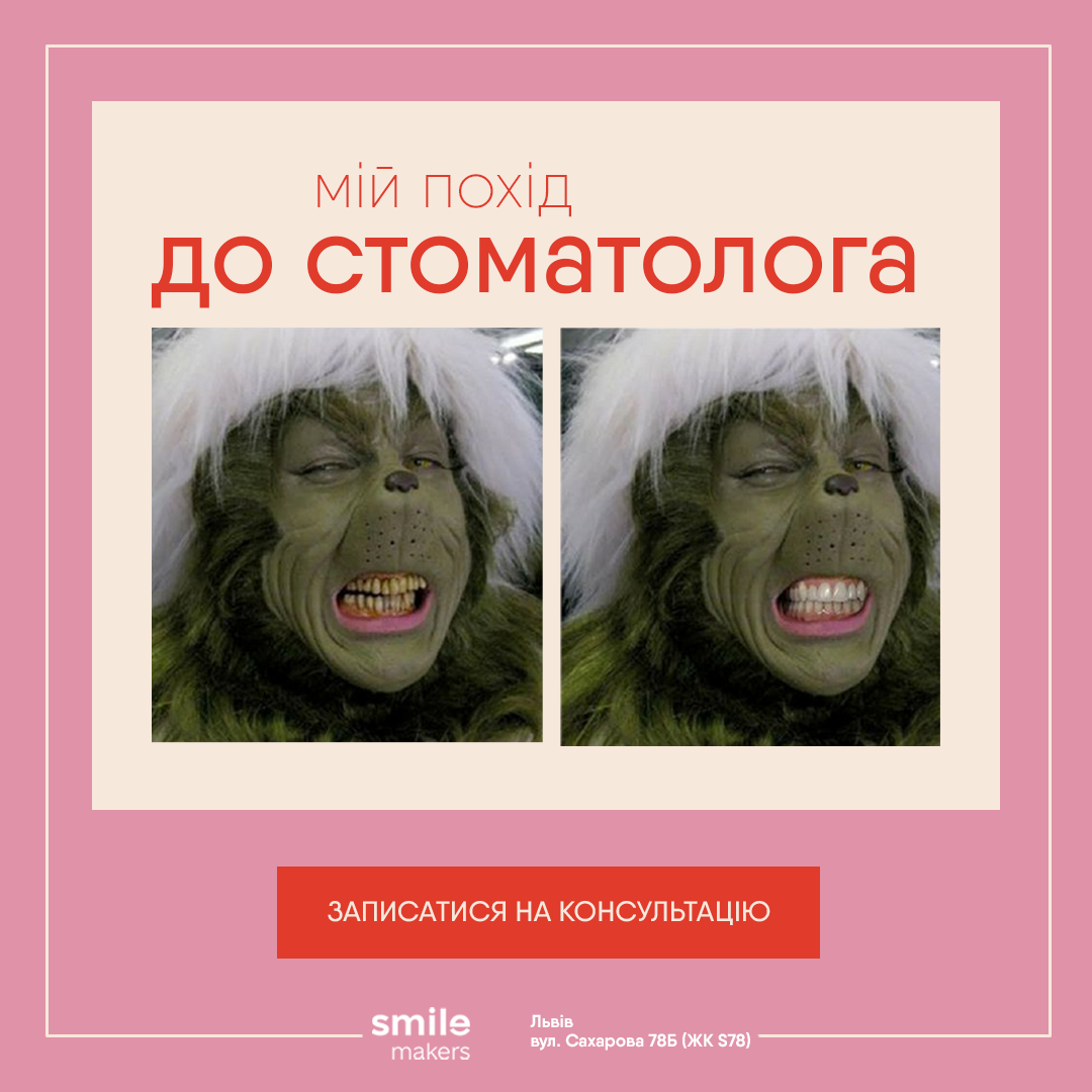 Фото Креативна реклама для стоматології