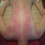 Массаж Гуаша