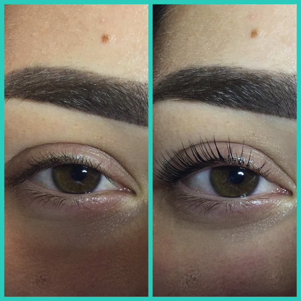 Фото Ламинирование ресничек + Botox