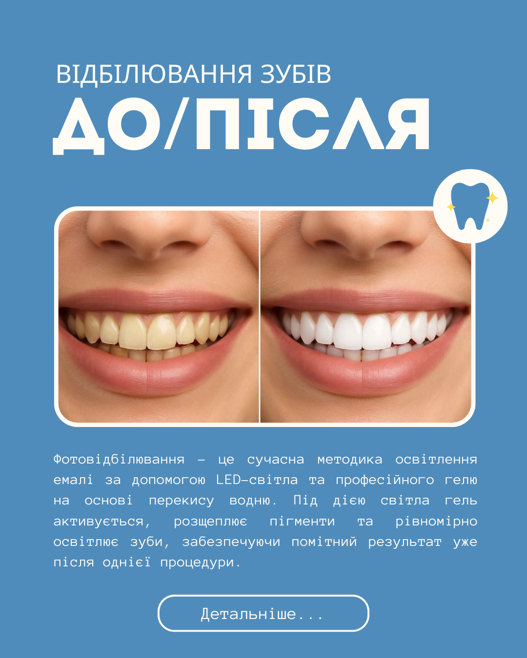 Фото Стоматологія. До/після. 