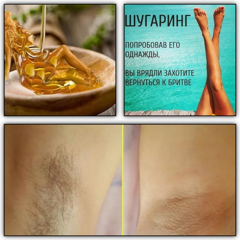 Фото Шугаринг 1