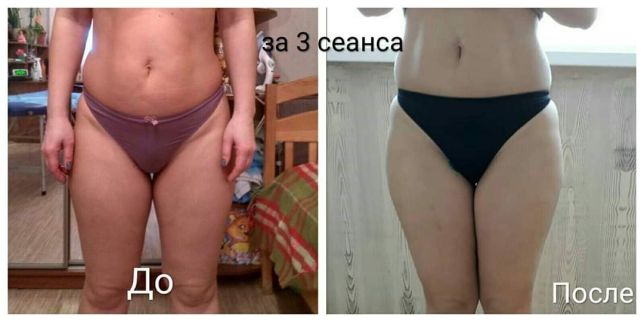 Фото Массаж для похудения 2