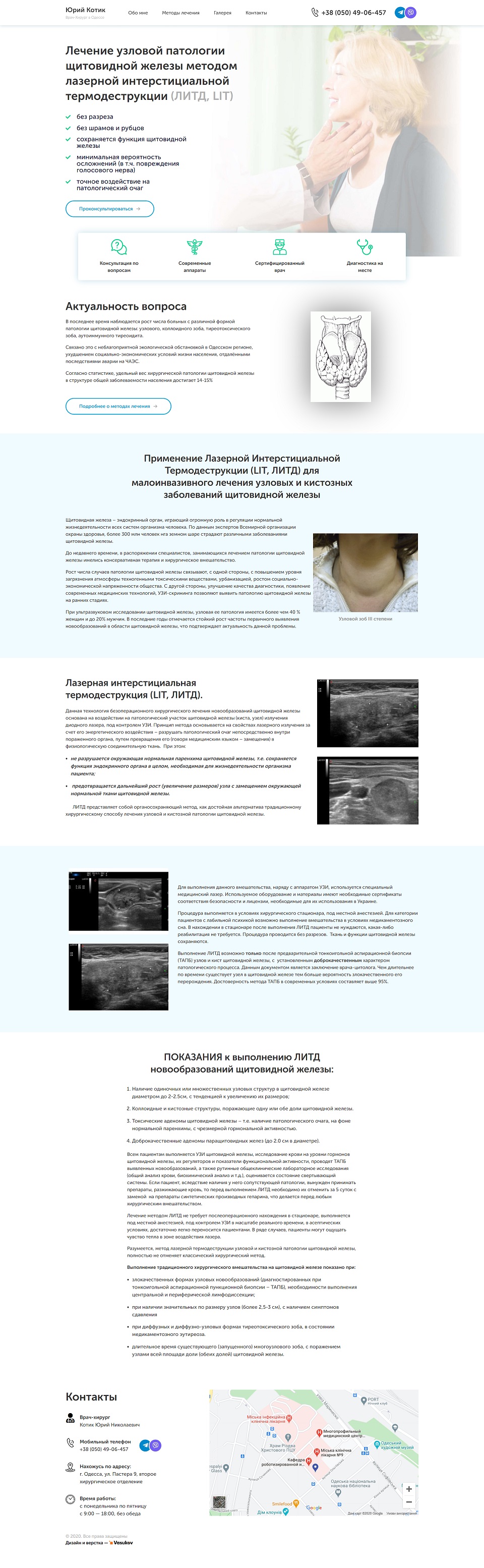 Фото Сайт врача-хирурга в Одессе.
https://newsurgery.org.ua/