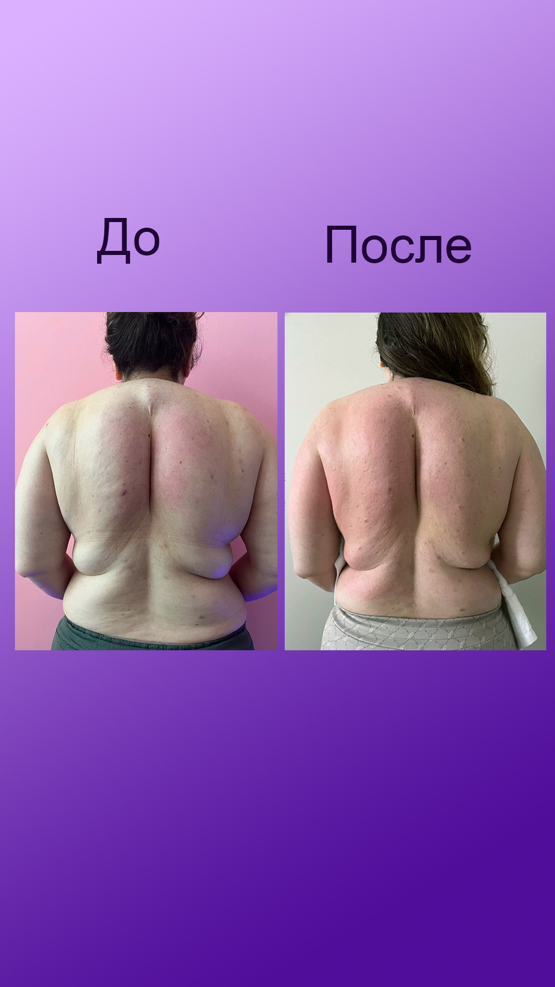 Фото 5 ручных массажей,работа после оперции