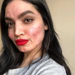 Ретуш, прибрати акне (вирівняти текстуру шкіри)